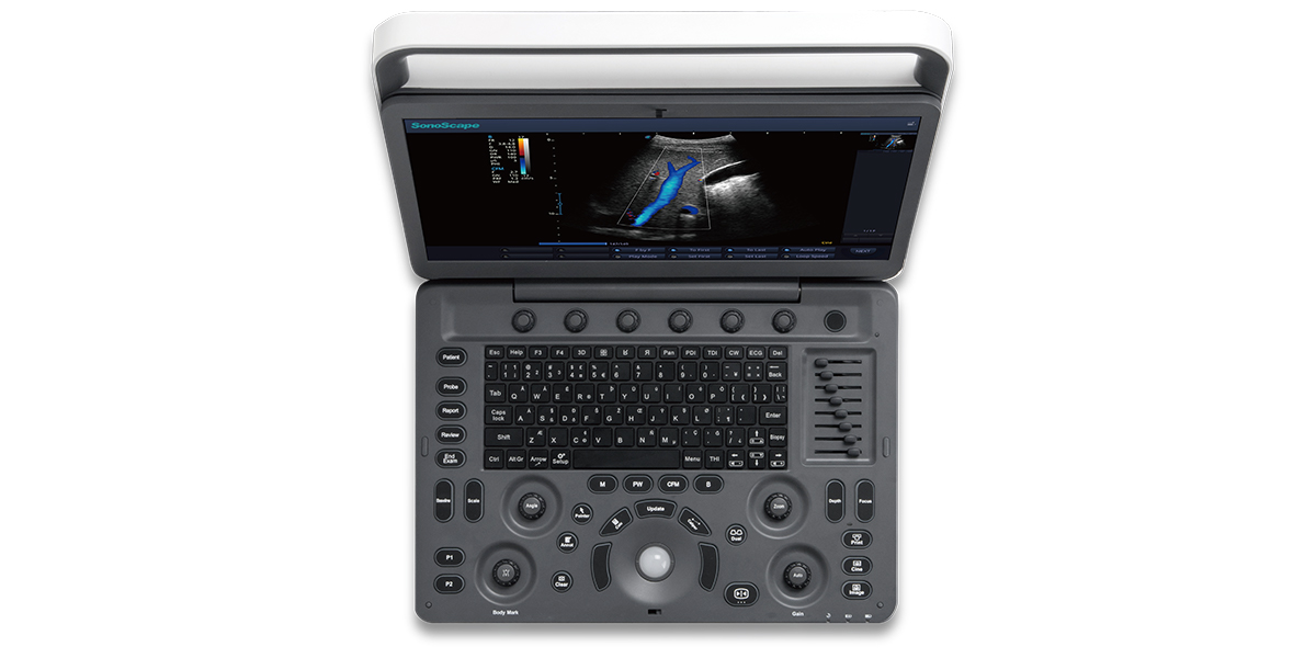 Échographe Doppler Couleur Portable