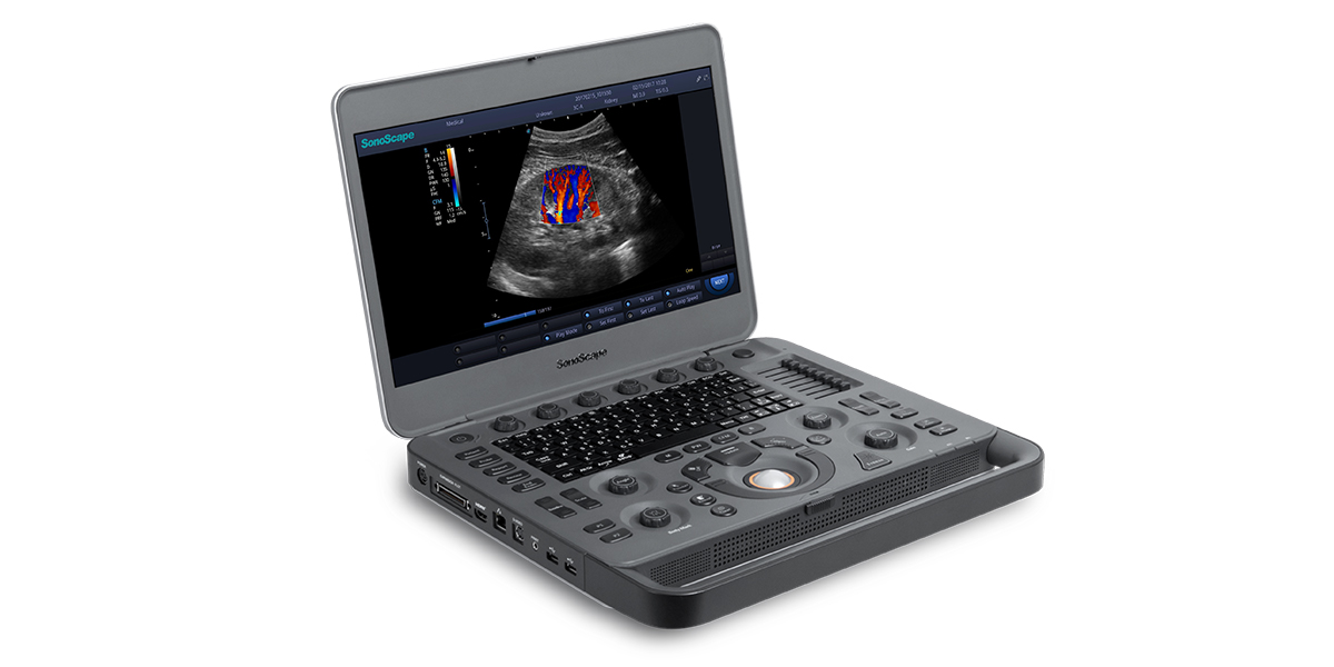 Échographe Portable Intelligent